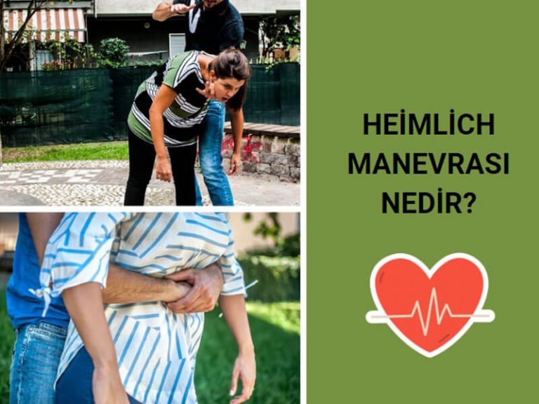 Heimlich Manevrası Nedir, Nasıl Yapılır?
