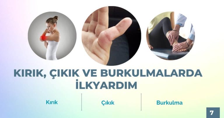 Kırık Çıkık burkulma